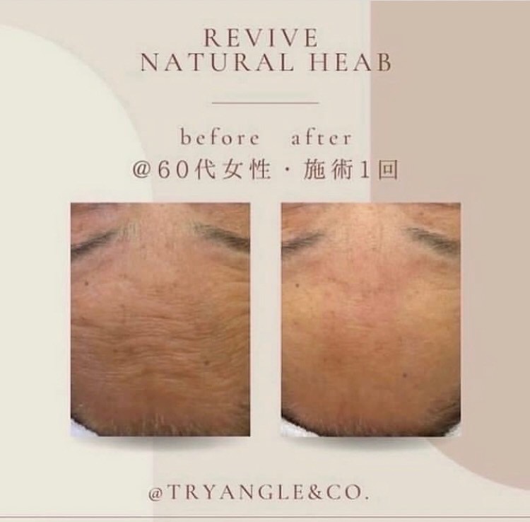REVIVE 純国産ハーブピーリングの画像